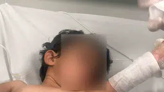 Şırnak'ta banyo için ısıtılan kaynar su 3 yaşındaki çocuğun üzerine devrildi