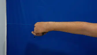 Kıyma makinesine elini kaptıran çocuğa tıp dünyasını şaşırtan nadir ameliyat!