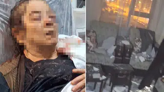 Kayseri'de kadın oturduğu odada kabusu yaşadı: Ağır yaralanan F.Ö. hastaneye kaldırıldı