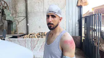 Şanlıurfa'da yavaş giden sürücüye darp: Burnu kırıldı, 8 dikiş atıldı