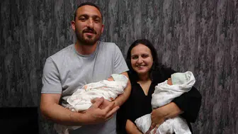 Trabzon'da nadir görülen gebelikle iki bebek dünyaya geldi