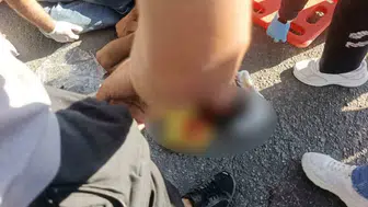 Siirt'te otomobil ile motosiklet çarpışması: Bir kişi ağır yaralı
