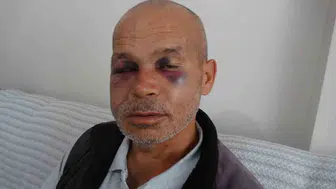 Engelli bireyi darbeden şüpheli serbest kaldı: Olayın detayları ortaya çıktı