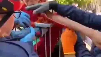 Oyun oynarken koluna korkuluk demiri saplanan çocuk hastanede tedavi edildi