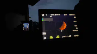 Samsunlu doktorun gökyüzü tutkusuyla çektiği fotoğraflar dünya çapında ses getiriyor