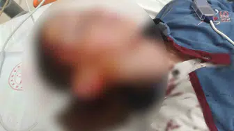 İzmir'de köpek saldırısında yaralanan çocuğa tazminat hükmedildi