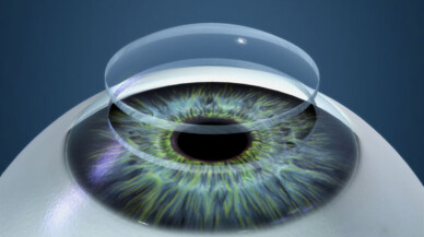 Ekran izleme süresinin uzaması göz kuruluğu ve şaşılık riskini artırıyor