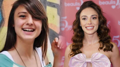 Rabia Soytürk Estetikli Mi? Eski Hali ve Yeni Hali, Burnu Estetik Mi?