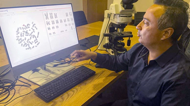 Down sendromu anne karnında yapay zekayla tespit ediliyor