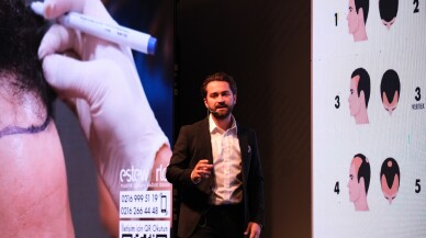 Burak Tuncer saç tedavilerindeki yenilikleri paylaştı