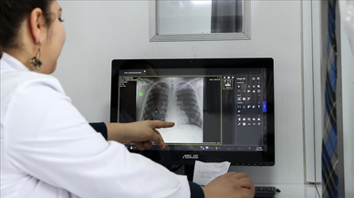 DSÖ'den tüberküloz uyarısı: 1995'ten bu yana en yüksek oran