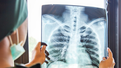 Zatürrenin erken teşhisi tedaviyi kolaylaştırıyor