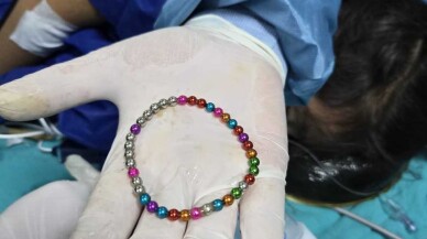 Bursa'da 5 yaşındaki çocuğun bağırsağından 38 mıknatıs çıkarıldı