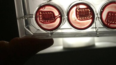 Hastaların kanıyla kırık kemikleri tedavi edecek implant geliştirildi