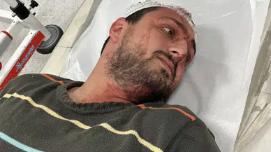 Savunmasızdı... Otizmli gence odunla dehşet!