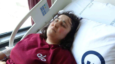 Gümüşhane’de kadına şiddet sokağa taştı: Boşanma aşamasındaki eşi arkadan saldırdı!