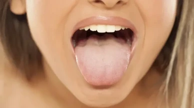 Diliniz Sarıysa Dikkat! Uzmanlar Uyarıyor