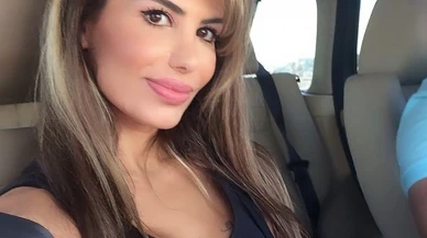 Şarkıcı Hatice’den Korkutan Açıklama: Botoks Zehirlenmesi Geçirdi!