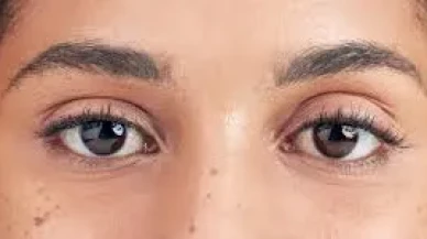 Göz Kapağı Düşüklüğünü Önlemek İçin Göz Egzersizleri ve Doğal Çözümler!