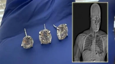 Akıllara Durgunluk Veren Soygun: Çaldığı Küpeleri Midesine Sakladı!