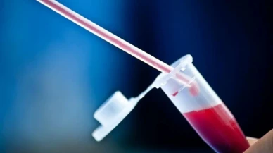 Kan Grubuna Göre Kanser Riski Açıklandı! Siz Hangi Gruptasınız?