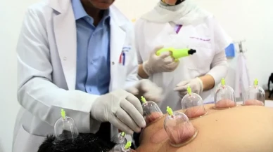 Hacamat Nedir, Faydaları Nelerdir, 2025'te Hangi Günler Yapılır, Noktaları Nelerdir?