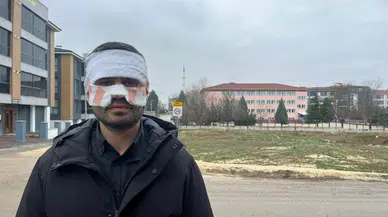 Okulda dehşet anları! Kaynar çay öğretmenin yüzüne fırlatıldı