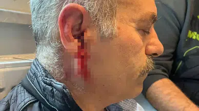 Çıkış işlemi için gitti, hastanelik oldu... İstanbul’da özel kurumda şiddet iddiası!