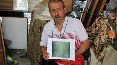 Doktorun unuttuğu parça hayatını bitirdi: Şimdi kimse çıkarmaya yanaşmıyor!