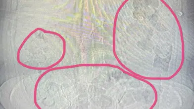 Sakarya'da midesinde uyuşturucu taşıyan İran uyruklu şüpheli tutuklandı