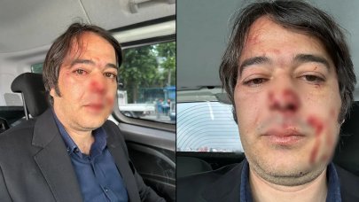 İBB İmar Şube Müdürü'ne saldırıda tutuklama