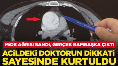 Mide ağrısı sandı, gerçek bambaşka çıktı: Acildeki doktorun dikkati sayesinde kurtuldu