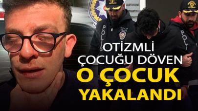 Otizmli çocuk Taha Alper Behrem'i döven o çocuk yakalandı!