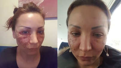 Bulgar modelin estetik kabusu