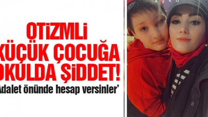 Küçük çocuğa büyük şiddet