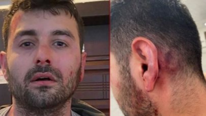 Antalyasporlu Veysel Sarı'nın kardeşiyle kiracıları karakolluk oldu