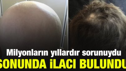 Kellik ilacı bulundu: FDA onayladı, yakında kullanılmaya başlanacak