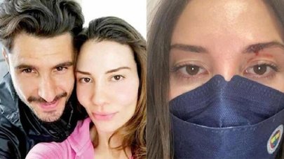 Futbolcu Özer Hurmacı'ya para cezası