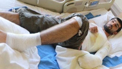 Epilepsi nöbeti geçirirken, kelle paça çorbası kazanına düştü