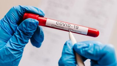 Araştırma yapıldı: İşte koronavirüse yakalanmayanların sırrı