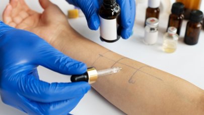 Alerjik reaksiyon artıyor