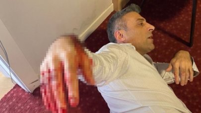 Yenilik Partisi Genel Başkanı Öztürk Yılmaz'ı bıçaklayan kişi Bolu'da yakalandı