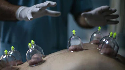 CERRAH ELİYLE GELENEKSEL TIP