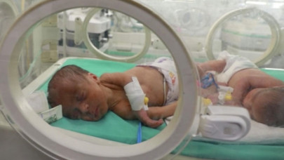 Gazze Şifa Hastanesi Kadın Doğum Uzmanı Malhis: Ne temiz su var ne ısınma var ne mama var