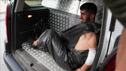 Polisi şehit eden saldırgana çöp muamelesi!