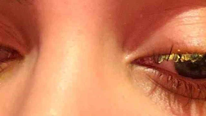 Esenyurt'ta güzellik merkezi faciası: Kirpik yaptırayım derken kör oluyordu!