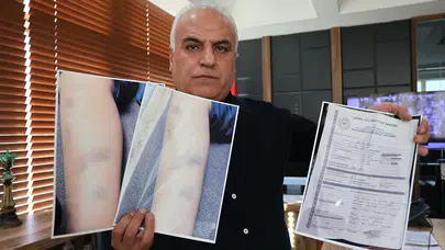 8 Yaşındaki öğrencinin iddiası yargıya taşındı: 'Müdür saçımdan tutup duvara vurdu'