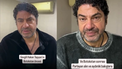 Ünlü Arabeskçi Hakan Taşıyan Estetik Yaptırdı! Yeni Görüntüsü Olay Oldu!