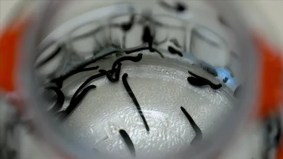 Sülük Salgısından Yeni Tedavi Yolda: MS ve Romatizma Hastalarına Umut Olabilir