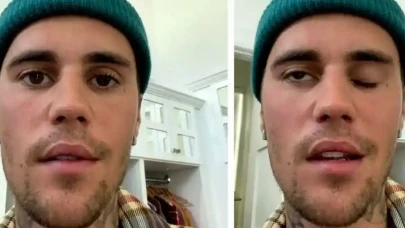 Justin Bieber’ın Sağlık Durumu Nasıl? Ramsay Hunt Sendromu Nedir? Bulaşıcı Mı?